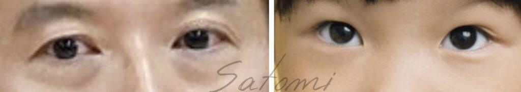 斎藤元彦とののかちゃんの目元