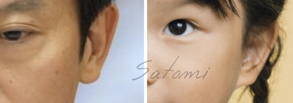 斎藤元彦とののかちゃんの耳